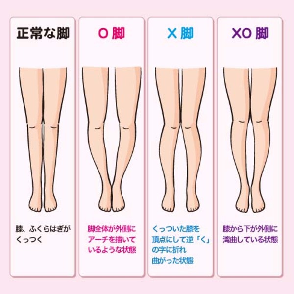突然膝の内側が痛い!?原因や治療法は?ストレッチで腫れは引くの? ネタバズ 突然膝の内側が痛い!?原因や治療法は?ストレッチで腫れは引くの? ネタバズ